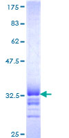 12.5% SDS-PAGE Stained with Coomassie Blue.